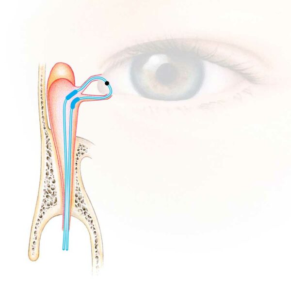 Ritleng®+ | Autostable Ritleng® Intubation - Image 4