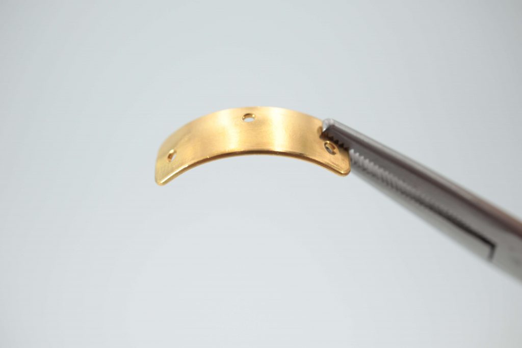 Oculid Gold Slim implant